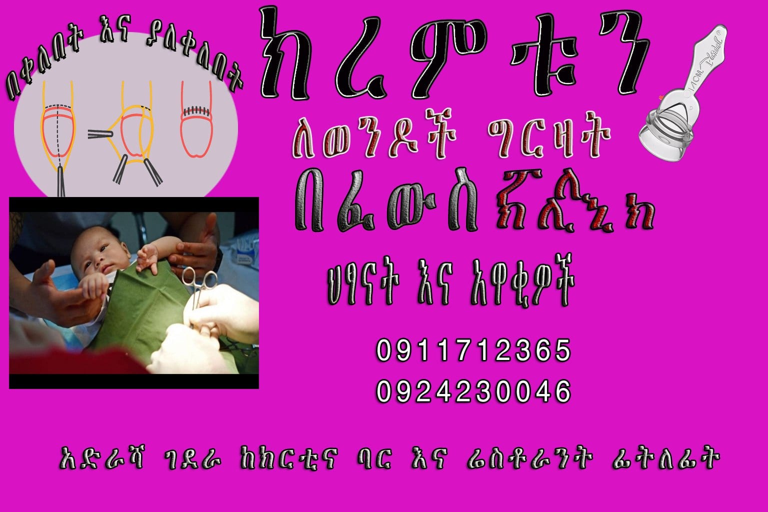 የወንዶች የግርዛት አገልግሎት